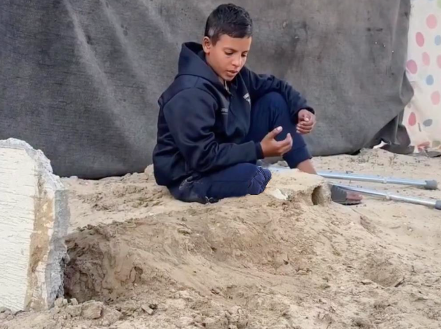 85. Child buries his own leg [$2000]